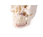 Preview: Schädelmodell für Zahnmedizin und Kieferchirurgie 5-teilig